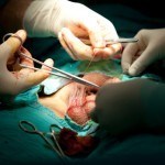 penis surgery